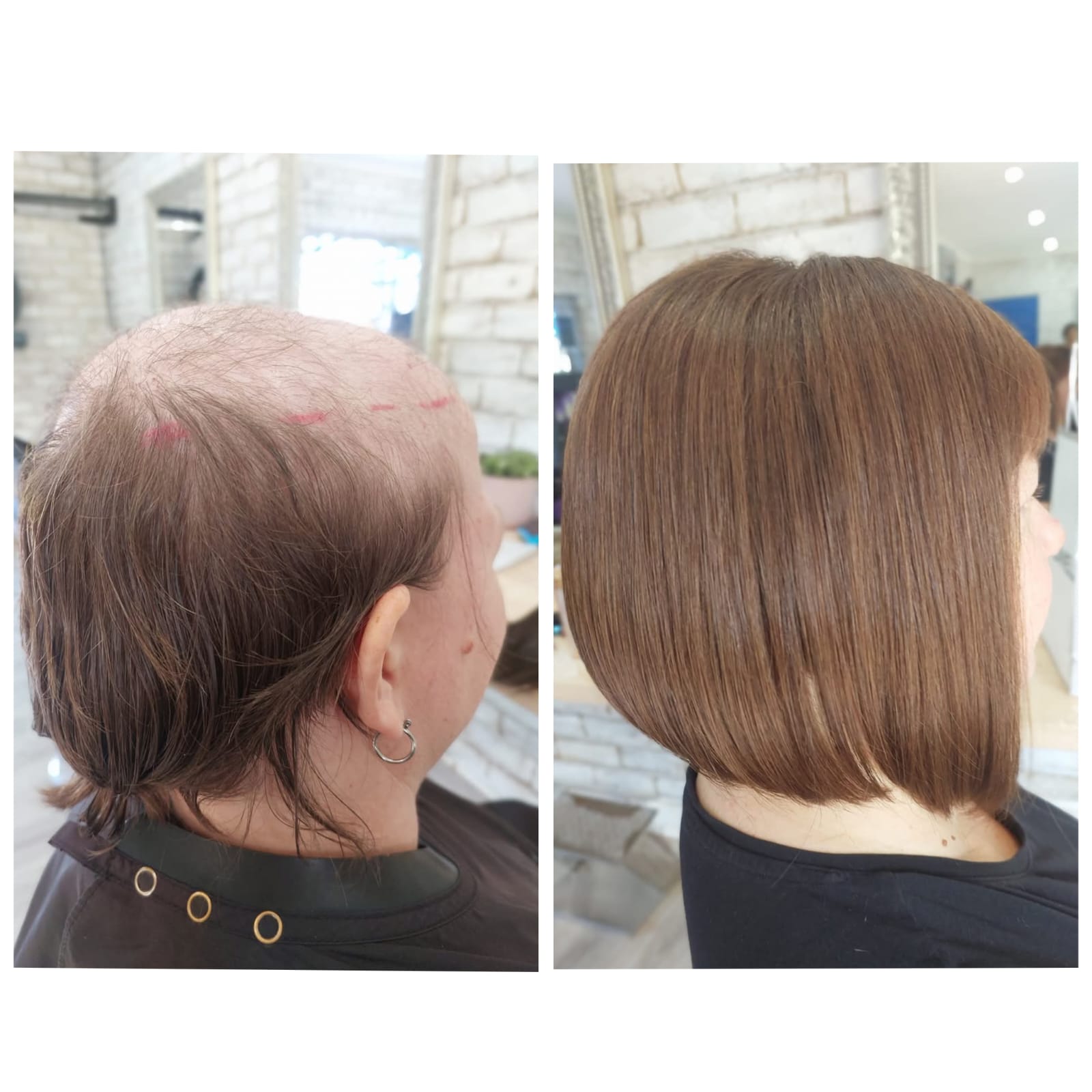 Before & After 4